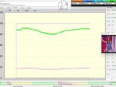 dxsatcs-eutelsat-5 west B-transalpine-dvb-s2-multistream-technology-reception-12 585-mhz-h-cc-mux-italy-SM-01